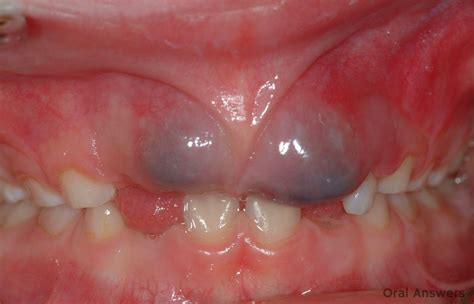 Pediatric Dentistry Oral Answers