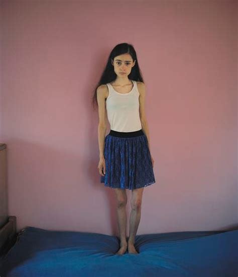 Heartbreaking Photos Show How A Group Of Girls Is Dealing With Anorexia