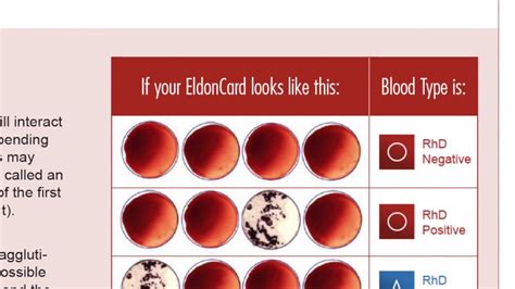Home Blood Typing Kit Tutorial Blood Type Test Kit