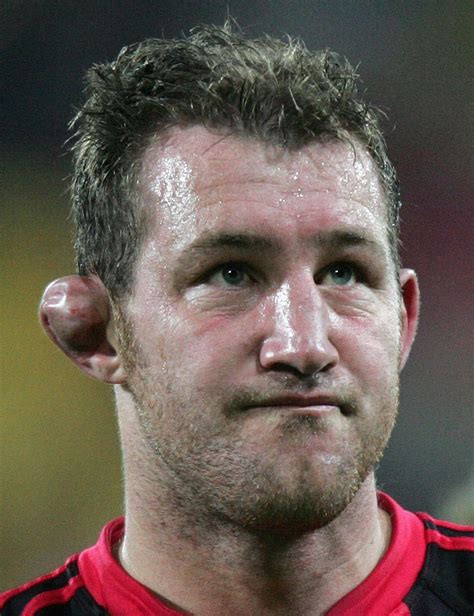 The Worst Ears In Rugby Mirror Online