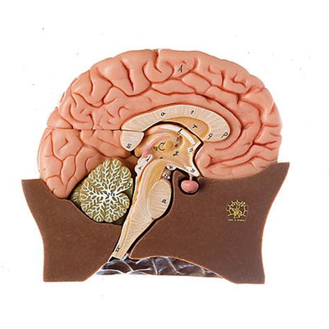 Somso Half Of The Brain Anatomical Model