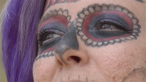 Alyssa Zebraskys Face Tattoo Removal Journey Removery