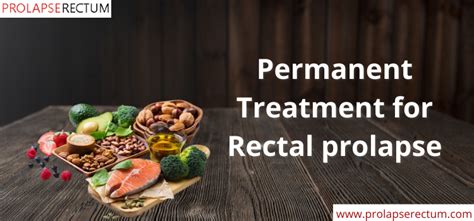 Permanent Treatment For Rectal Prolapse