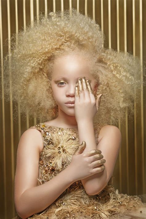 Afroart Series Beauty Albinism Natural Hair Styles