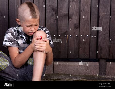 Young Injured Boy With Bleeding Knee Sitting Down Outside Stock Photo
