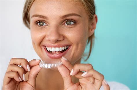 What Are The Advantages Of Invisalign Coquitlam Invisalign