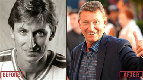 Wayne Gretzky Before And After Plastic Surgery Pictures Every Details
