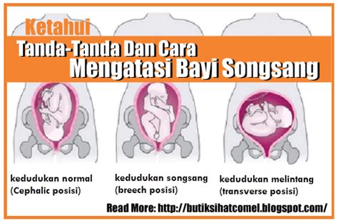 Rasiyambumen.com kajian khazanah islam (kategori posting mu'amalah). Tips Semulajadi Membetulkan Kedudukan Songsang Bayi Dalam ...
