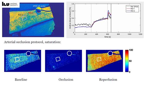 Hyperspectral Imaging On Chip Real Time And Compact Imec