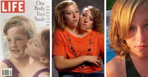 What Do They Look Like Now Conjoined Twins Abby And Brittany Hensel In