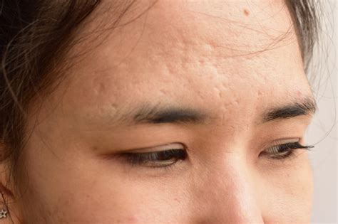 Premium Photo Skin Problems And Wrinkles On The Face Of Women