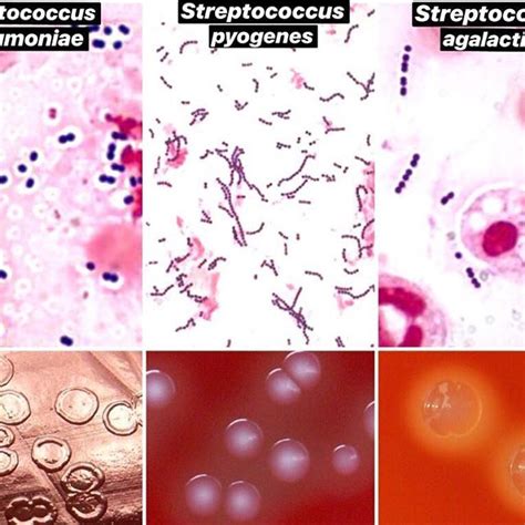 1 Streptococcus Pneumoniae 2 Streptococcus Pyogenes 3 Streptococcus Agalactiae Gram Stain