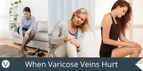 When Varicose Veins Hurt The Vein Institute At Ssa