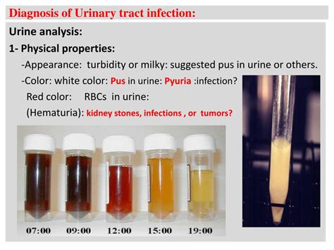 Ppt Urinary Tract Infection Uti Powerpoint Presentation Free Download Id