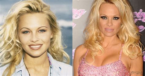 Celebrities Who Looked Better Before Going Under The Knife