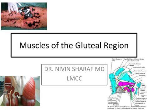 Ppt Muscles Of The Gluteal Region Powerpoint Presentation Free