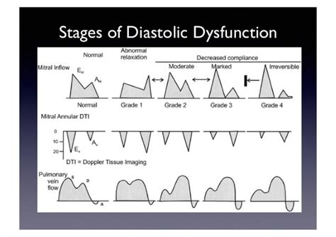 What Is Stage 3 Diastolic Dysfunction Shannon Lansberrys English