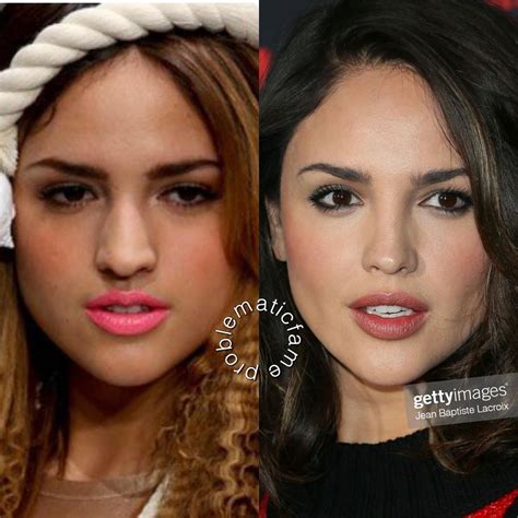 Facetune Eiza Gonzalez Madison Beer Plastic Surgery Then And Now