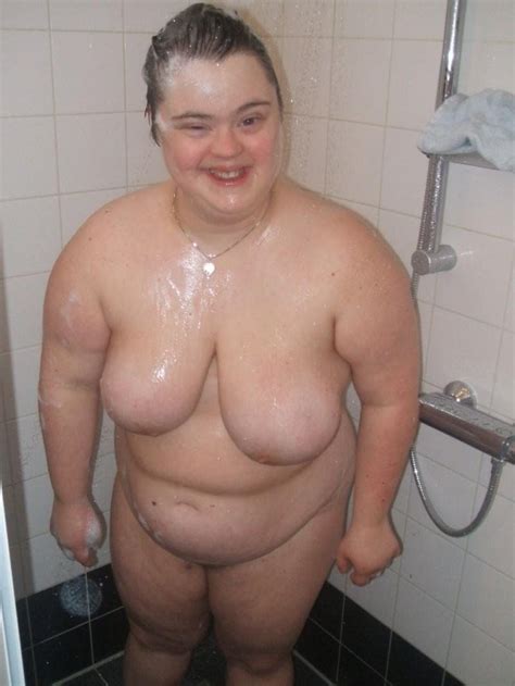 Nude Downs Syndrome Women Xxx Pics