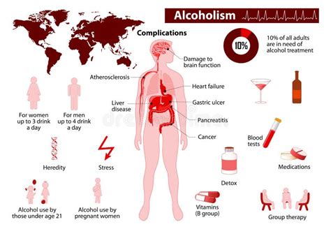 Danger Of Alcoholism Infographic Drunk Alcoholic Chained Stock Vector