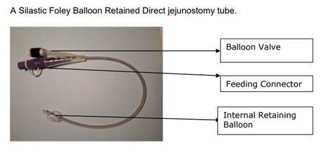 Direct Surgically Placed Jejunostomy Tube Information For Parents