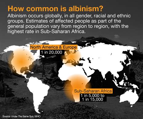 What Is Albinism And What Causes It Infographic News Al Jazeera