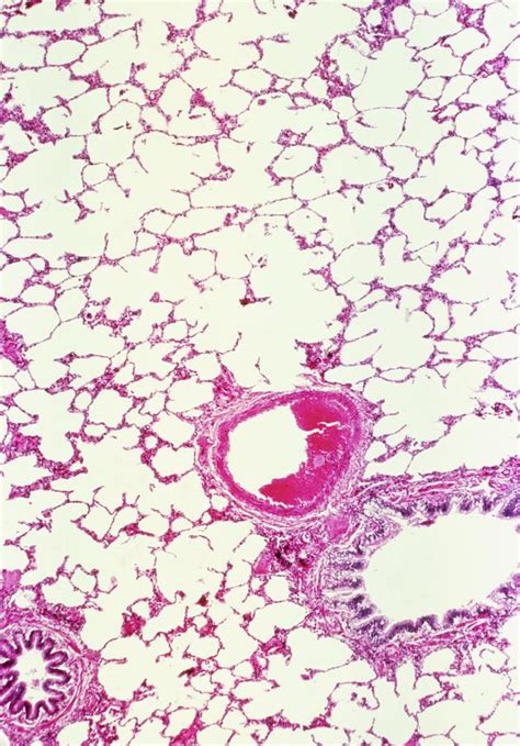 Lm Of A Cross Section Through Lung Tissue Photograph By Biophoto
