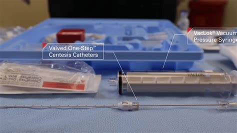Valved One Step Centesis Catheters For A Smooth Transition
