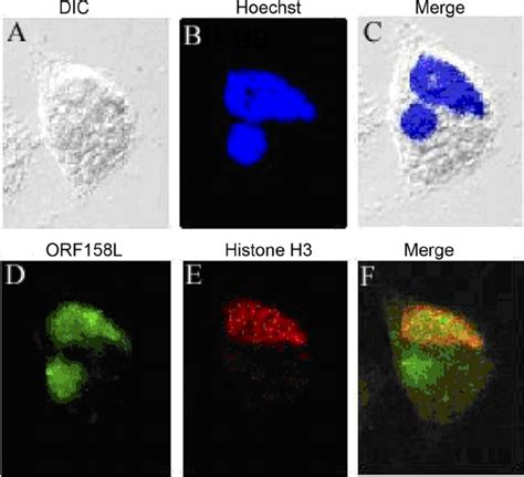 Colocalization Of Orf With Histone H A A Cell In A Dic Image