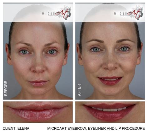Microart semi permanent lip enhancement is a breakthrough procedure, eliminating all the side effects of touch up appointment: Permanent Makeup Lips by MicroArt Semi Permanent Makeup