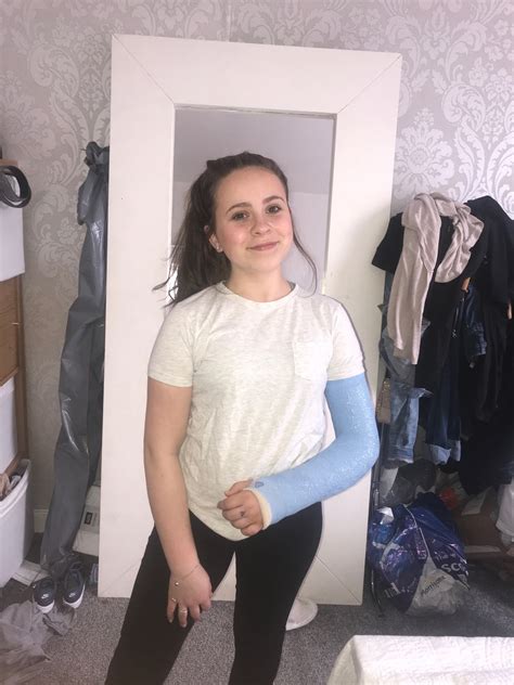 Moment Young Scots Gymnast Suffers Horror Arm Break As Loud Snap Prompts Stunned Gasps From The