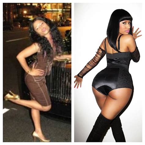 Nicki Minajs Before And After Plastic Surgery Photos Look Extremely Different Ags Tools