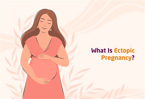 Everything You Need To Know About Ectopic Pregnancy