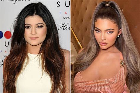 What Did Kylie Jenner Look Like Before And After Lip Filler 247 News Around The World