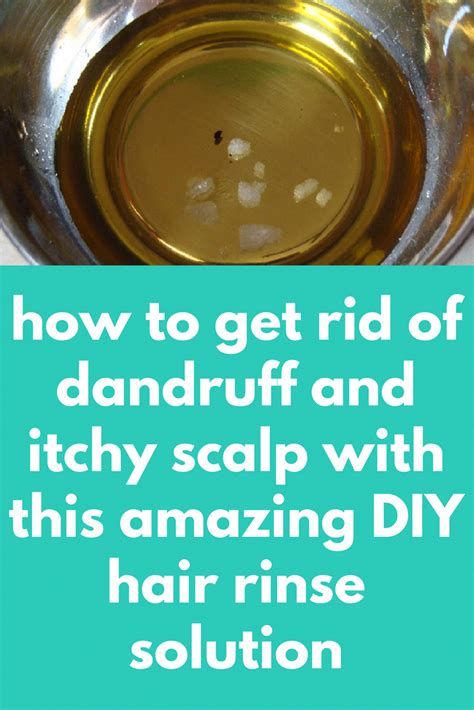 Jul 09, 2020 · baking soda is also known to reduce the overactive fungi that can cause dandruff. how to get rid of dandruff and itchy scalp with this ...