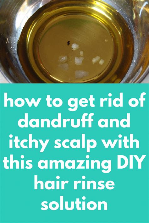 However, if your issue is severe. how to get rid of dandruff and itchy scalp with this ...