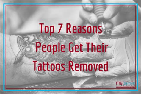 Top 7 Reasons People Remove Their Tattoos Medermis Laser Clinic