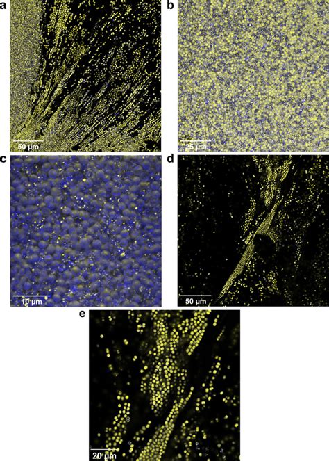 Formation Of Vipp1 Gfp Puncta In Dense Regions Of Flocs Confocal