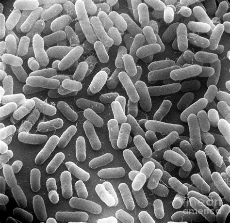 Coli have taught us so much about life over the years, and how they continue to do so. Bacteria E Coli Electron Microscope - Micropedia