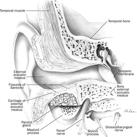 The Changing Face Of Malignant Necrotising External Otitis Clinical