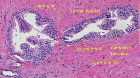 Prostate Tissue Image Components Gland And The Main Tissue Components