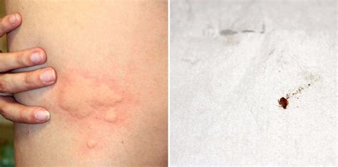 How To Know If A Bed Bug Bite You Bed Western