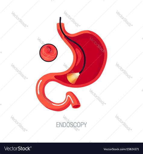Endoscopy Diagnostic Concept In Flat Style Vector Image