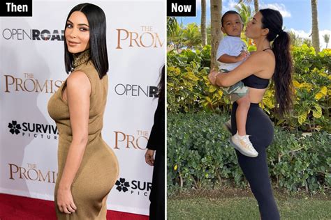 Kim Kardashian Plastic Surgery Journey Before After