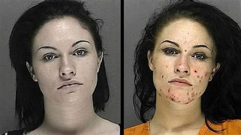 Meth Effects Before And After