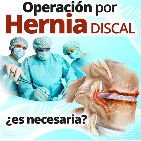 ¿la Operación Por Hernia Discal Es Necesaria Cordus España