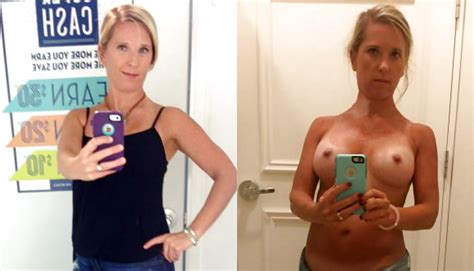 Wife Before And After Boob Job Haunt Porn Photos