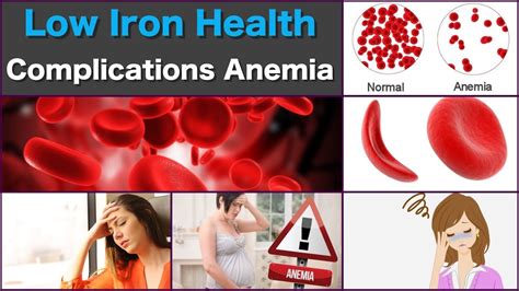 Low Iron Health Complications Of Low Iron Deficiency Anemia Youtube