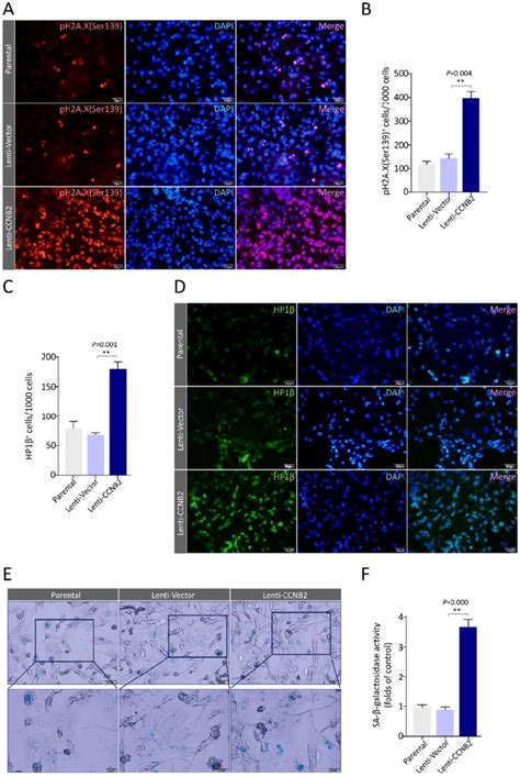 Ccnb2 Induces Senescence Of Glioma Cells A Representative