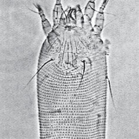Bermuda Grass Mite A Cynodoniensis Microscope Photograph Of A Female